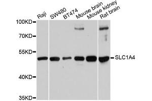 Western blot analysis of extracts of various cell lines, using SLC1A4 antibody.