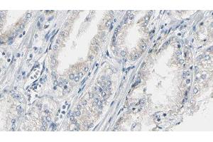 ABIN6274988 at 1/100 staining Human prostate tissue by IHC-P. (CEP170 Antikörper  (Internal Region))