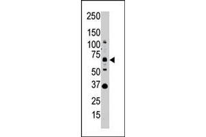 Western blot analysis of SENP1 polyclonal antibody  in whole HL-60 cell lysate : SENP1 (Arrow) was detected using purified polyclonal antibody.