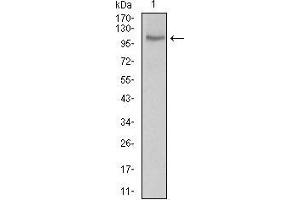 Western blot analysis using CLGN mouse mAb against LNCAP cell lysate.