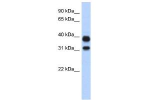 WB Suggested Anti-CHIA Antibody Titration:  0. (CHIA Antikörper  (N-Term))