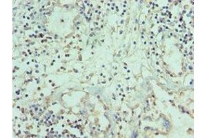 Immunohistochemistry (IHC) image for anti-Tumor Necrosis Factor (Ligand) Superfamily, Member 12 (TNFSF12) (AA 42-123) antibody (ABIN7173794)