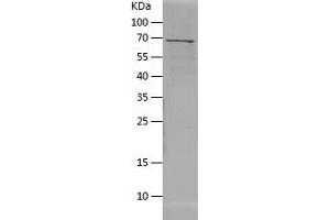 Western Blotting (WB) image for Arylacetamide Deacetylase (Esterase) (AADAC) (AA 24-399) protein (His-IF2DI Tag) (ABIN7121903)