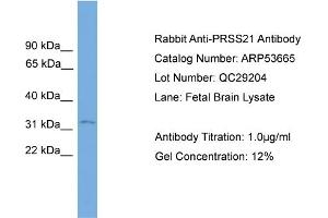 WB Suggested Anti-PRSS21  Antibody Titration: 0.