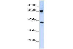 C6ORF134 antibody used at 1 ug/ml to detect target protein. (Chromosome 6 Open Reading Frame 134 (C6orf134) (Middle Region) Antikörper)