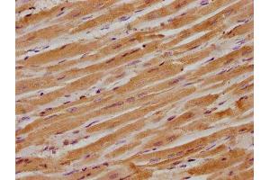 IHC image of ABIN7156473 diluted at 1:300 and staining in paraffin-embedded human heart tissue performed on a Leica BondTM system. (ITGB1BP1 Antikörper  (AA 1-200))