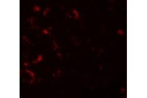 Immunofluorescencent staining of human brain cells with AXIN1 polyclonal antibody  at 20 ug/mL. (Axin Antikörper  (C-Term))