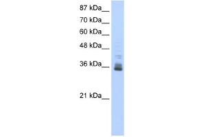 WB Suggested Anti-ZNF197 Antibody Titration:  0. (ZNF197 Antikörper  (N-Term))