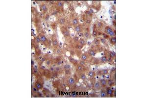 HSD17B4 Antibody (Center) (ABIN656447 and ABIN2845732) immunohistochemistry analysis in formalin fixed and paraffin embedded human liver tissue followed by peroxidase conjugation of the secondary antibody and DAB staining. (HSD17B4 Antikörper  (AA 341-370))