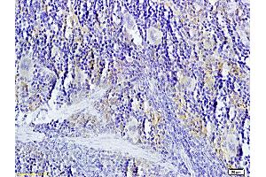 Formalin-fixed and paraffin-embedded: rat spleen tissue labeled with Rabbit Anti-TNFSF14 Polyclonal Antibody, Unconjugated (ABIN740625) 1:200 followed by conjugation to the secondary antibody and DAB staining (TNFSF14 Antikörper  (AA 141-240))