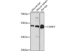 Western blot analysis of extracts of various cell lines, using CAMKV Rabbit pAb (ABIN7266051) at 1:1000 dilution. (CAMKV Antikörper  (AA 1-285))