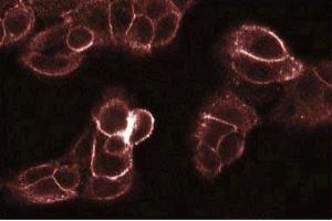 Immunofluorescence staining of A431 cells. (PKC theta Antikörper  (AA 21-217))