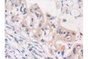 Immunohistochemistry (IHC) image for anti-Cytidine Deaminase (CDA) (AA 2-146) antibody (ABIN7440833)