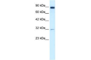 WB Suggested Anti-MMP9 Antibody Titration:  1. (MMP 9 Antikörper  (N-Term))