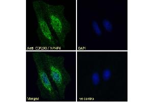 ABIN334371 Immunofluorescence analysis of paraformaldehyde fixed HeLa cells, permeabilized with 0. (CEP290 Antikörper  (Internal Region))