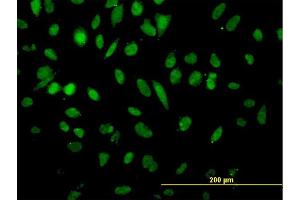 Immunofluorescence of monoclonal antibody to NFX1 on HeLa cell. (NFX1 Antikörper  (AA 981-1080))