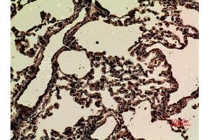 Immunohistochemistry (IHC) image for anti-Junctional Adhesion Molecule 2 (JAM2) (Internal Region) antibody (ABIN3187667)