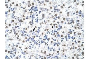 MSI2 antibody was used for immunohistochemistry at a concentration of 4-8 ug/ml to stain Hepatocytes (arrows) in Human Liver.