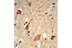 Immunohistochemistry analysis in formalin-fixed and paraffin-embedded human brain tissue reacted with GALNT2 Antibody (N-term) followed which was peroxidase-conjugated to the secondary antibody, followed by DAB staining.