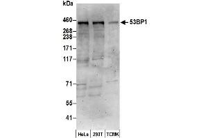 Western Blotting (WB) image for anti-Tumor Protein P53 Binding Protein 1 (TP53BP1) (C-Term) antibody (ABIN7452867)