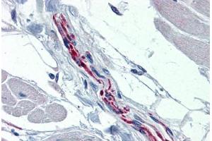Human Heart, Nerve (formalin-fixed, paraffin-embedded) stained with TH antibody ABIN364267 at 1:100 followed by biotinylated goat anti-rabbit IgG secondary antibody ABIN481713, alkaline phosphatase-streptavidin and chromogen. (Tyrosine Hydroxylase Antikörper)