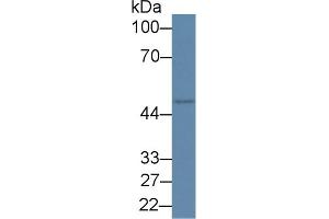 Detection of RIPK2 in Rat Placenta lysate using Polyclonal Antibody to Receptor Interacting Serine Threonine Kinase 2 (RIPK2) (RIPK2 Antikörper  (AA 1-294))