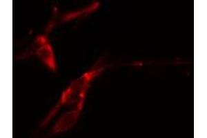 ABIN6274364 staining COLO205 cells by IF/ICC. (ANKRD1 Antikörper  (Internal Region))