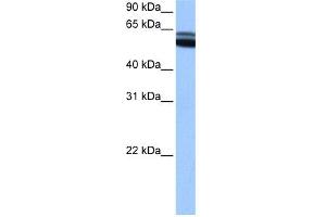 WB Suggested Anti-RARB Antibody Titration:  0. (Retinoic Acid Receptor beta Antikörper  (C-Term))