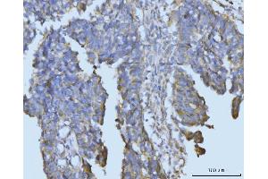 IHC analysis of BCKDK using anti-BCKDK antibody (ABIN7601470). (BCKDK Antikörper  (AA 36-316))