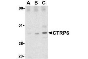 Western Blotting (WB) image for anti-Complement C1q Tumor Necrosis Factor-Related Protein 6 (C1QTNF6) (Intermediate Domain) antibody (ABIN499679)