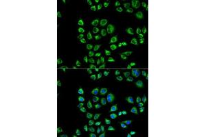 Immunofluorescence analysis of HeLa cells using CD1D antibody (ABIN3022497, ABIN3022498, ABIN3022499 and ABIN6218859). (CD1d Antikörper  (AA 20-190))
