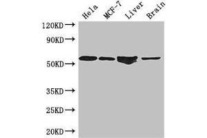 Western Blot Positive WB detected in: Hela whole cell lysate, MCF-7 whole cell lysate, Mouse liver tissue, Mouse brain tissue All lanes: ETS2 antibody at 2. (ETS2 Antikörper  (AA 9-185))