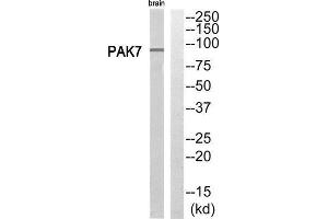 Western Blotting (WB) image for anti-P21 Protein (Cdc42/Rac)-Activated Kinase 7 (PAK7) (C-Term) antibody (ABIN1852718) (PAK7 Antikörper  (C-Term))