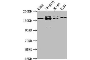 Western Blot Positive WB detected in: K562 whole cell lysate, SH-SY5Y whole cell lysate, HL-60 whole cell lysate, U251 whole cell lysate All lanes: AHI1 antibody at 1:2000 Secondary Goat polyclonal to rabbit IgG at 1/50000 dilution Predicted band size: 138, 121, 71 kDa Observed band size: 138 kDa (AHI1 Antikörper  (AA 1-213))