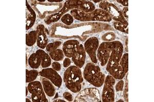 Immunohistochemical staining of human kidney with STARD10 polyclonal antibody  shows cytoplasmic and nuclear positivity in cells in tubules.