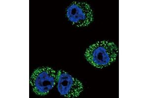 Immunofluorescence (IF) image for anti-Chemokine (C-C Motif) Receptor 7 (CCR7) antibody (ABIN5021834) (CCR7 Antikörper)