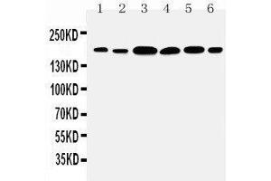 Anti-Laminin gamma 1 antibody, Western blotting Lane 1: Rat Kidney Tissue Lysate Lane 2: Rat Lung Tissue Lysate Lane 3: U87 Cell Lysate Lane 4: SMMC Cell Lysate Lane 5: HELA Cell Lysate Lane 6: SKOV1 Cell Lysate