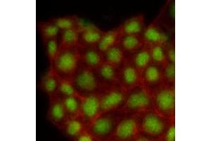 Immunofluorescence of human MCF7 cells stained with Phalloidin-TRITC (Red) for Actin staining and monoclonal anti-human MAPK1 antibody (1:500) with Alexa 488 (Green). (ERK2 Antikörper  (AA 1-360))