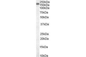 Western Blotting (WB) image for Squamous Cell Carcinoma Antigen Recognized By T Cells 3 (SART3) peptide (ABIN369434) (Squamous Cell Carcinoma Antigen Recognized By T Cells 3 (SART3) Peptid)