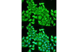 Immunofluorescence analysis of HeLa cells using RAB6A antibody (ABIN5973269). (RAB6A Antikörper)