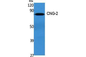Western Blot (WB) analysis of specific cells using CNG-2 Polyclonal Antibody. (CNGA2 Antikörper  (Internal Region))
