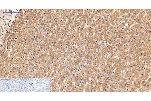 Immunohistochemistry of paraffin-embedded Human liver tissue using alpha Lactalbumin Monoclonal Antibody at dilution of 1:200.