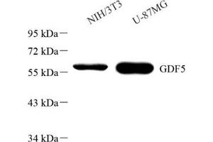 Western blot analysis of GDF5 (ABIN7074131)at dilution of 1: 1000 (GDF5 Antikörper)