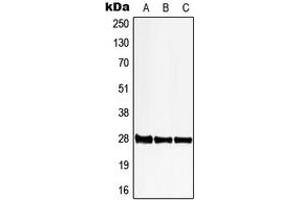 Western blot analysis of 6PGL expression in HeLa (A), SP2/0 (B), PC12 (C) whole cell lysates. (PGLS Antikörper  (C-Term))