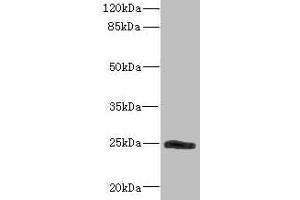 Western blot All lanes: SNRPB2 antibody IgG at 2.