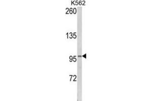 Western Blotting (WB) image for anti-Lipin 2 (LPIN2) antibody (ABIN3003814) (Lipin 2 Antikörper)