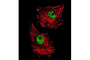 Confocal immunofluorescent analysis of FUS Antibody (C-term) (ABIN654146 and ABIN2844013) with MDA-M cell followed by Alexa Fluor 488-conjugated goat anti-rabbit lgG (green). (FUS Antikörper  (C-Term))