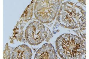 ABIN6269386 at 1/100 staining Mouse testis tissue by IHC-P.