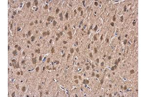 IHC-P Image HSP70 1A antibody detects HSP70 1A protein at cytoplasm in rat brain by immunohistochemical analysis. (HSP70 1A Antikörper  (Center))