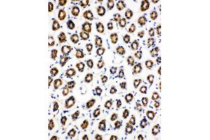 Anti-SDHC antibody, IHC(P) IHC(P): Rat Gaster Tissue (SDHC Antikörper  (N-Term))